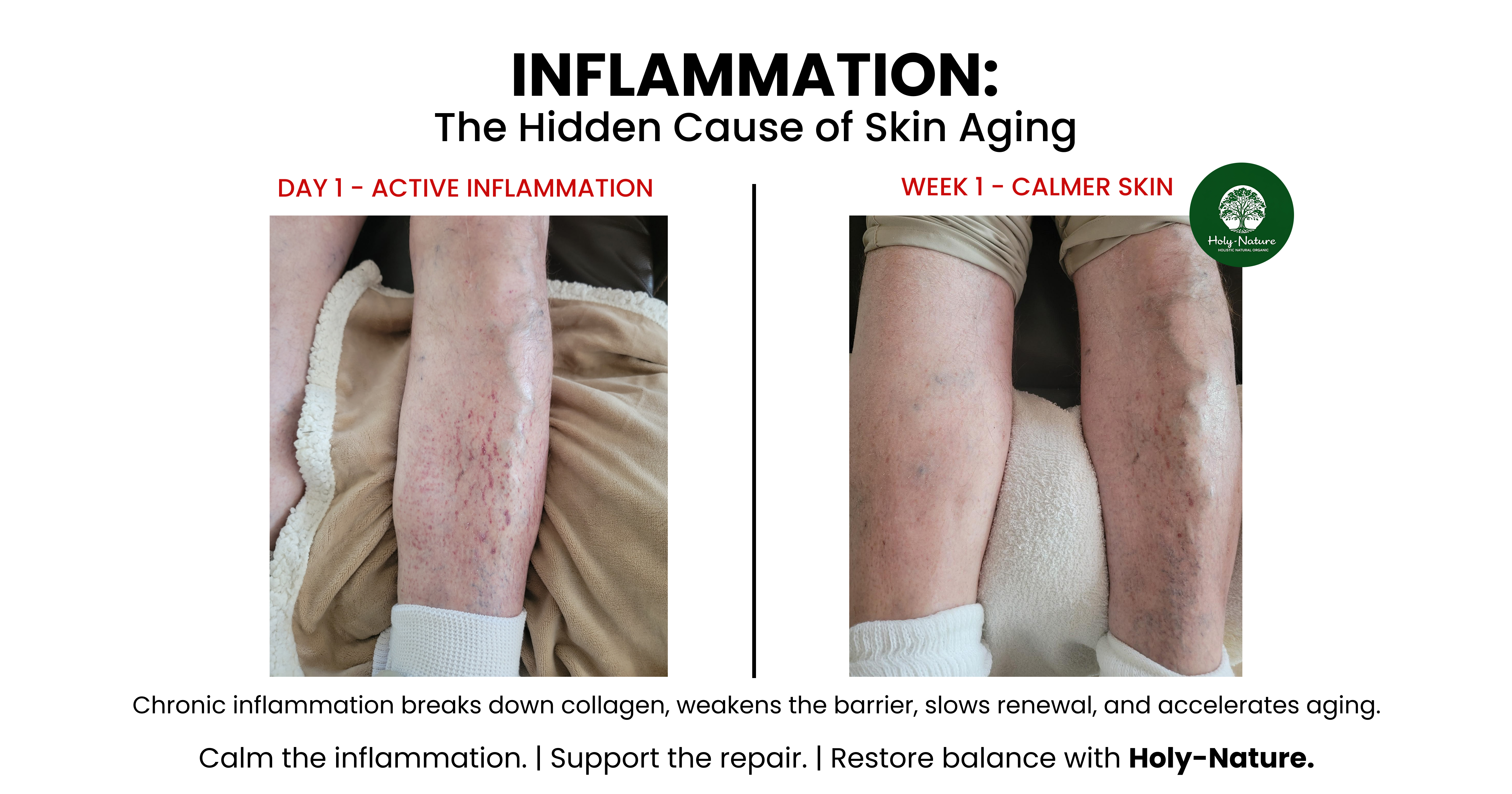 Inflammation: The Hidden Cause of Skin Aging